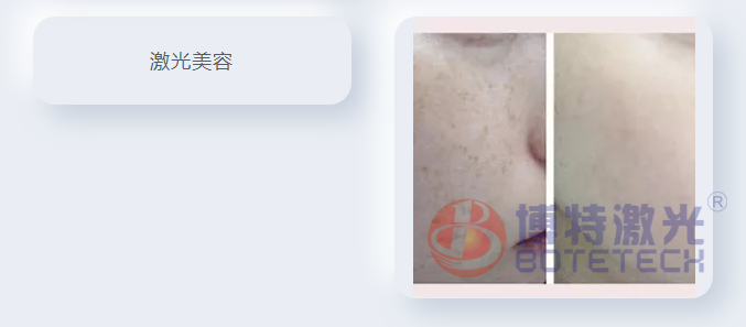 激光工艺 激光工艺